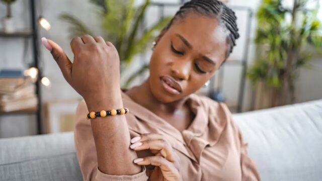 How to Tell if I Have Eczema or Ringworm? A Helpful Identification Guide 