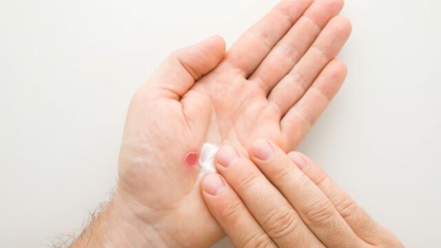 Best Ointment for Slow-Healing Wounds: What to Use When Standard Antibiotics Aren’t Enough