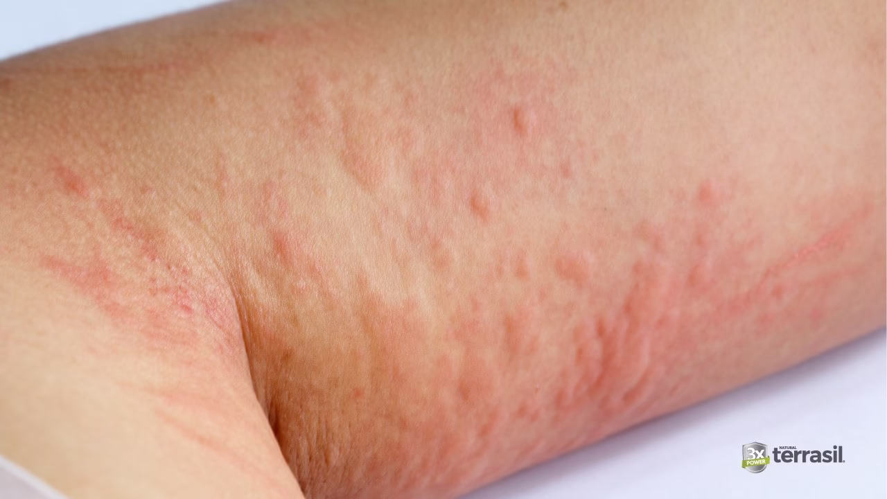 example of a swollen red rash